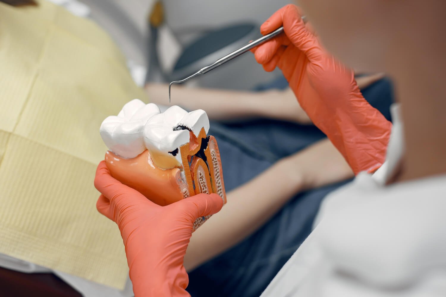 Dentista na Spazio Vita em Linhares ES usa modelo anatômico de dente para explicar o tratamento de canal sem dor de forma didática.